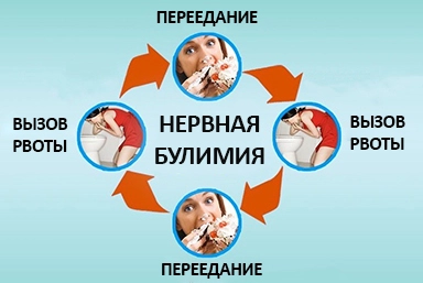Лечение булимии в Вилючинске